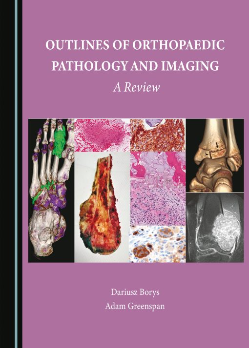 Outlines of Orthopaedic Pathology and Imaging: A Review (PDF)