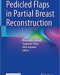 Pedicled Flaps in Partial Breast Reconstruction (EPUB)