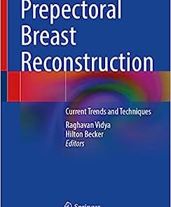 Prepectoral Breast Reconstruction: Current Trends and Techniques (EPUB)