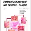 Rosazea – Klinik, Differentialdiagnostik und aktuelle Therapie (UNI-MED Science), 2nd Edition (PDF)