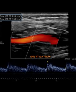 Society for Vascular Medicine Comprehensive Review of Vascular Ultrasound Interpretation and Registry Preparation 2023 (Course)