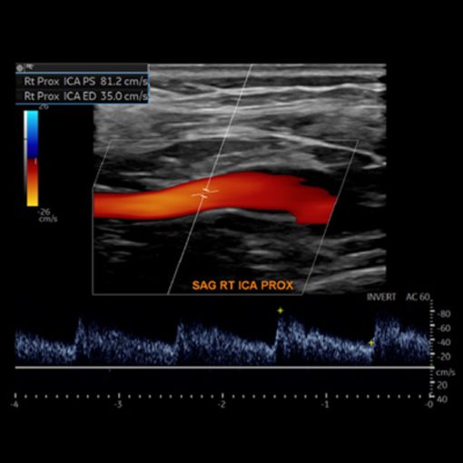 Society for Vascular Medicine Comprehensive Review of Vascular Ultrasound Interpretation and Registry Preparation 2023 (Course)