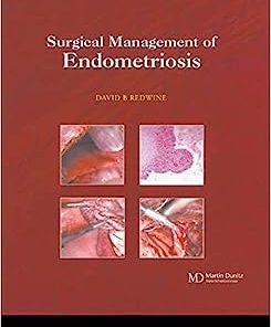 Surgical Management of Endometriosis (PDF)