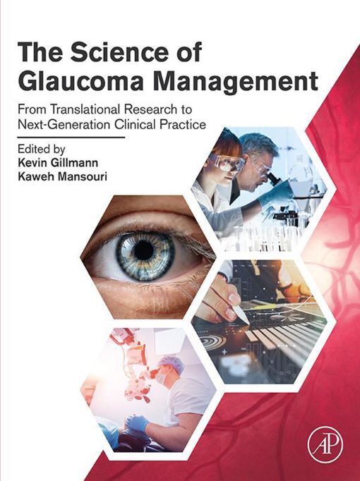 The Science of Glaucoma Management (EPUB)