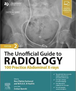 The Unofficial Guide to Radiology: 100 Practice Abdominal X-rays, 2nd edition (EPUB)