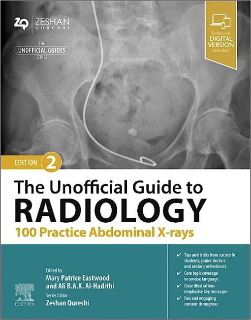 The Unofficial Guide to Radiology: 100 Practice Abdominal X-rays, 2nd edition (EPUB)