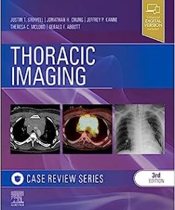 Thoracic Imaging: Case Review, 3rd edition (EPUB)