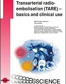 Transarterial radioembolisation (TARE) – basics and clinical use (UNI-MED Science) (PDF)