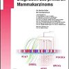 Tumorbiologie und Diagnostik des primären Mammakarzinoms (UNI-MED Science) (German Edition) (PDF)