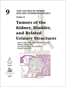 Tumors of the Kidney, Bladder, and Related Urinaray Structures (AFIP Atlases of Tumor and Non-tumor Pathology, Series 5, Volume 9) (PDF)