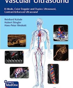 Vascular Ultrasound: B-Mode, Color Doppler and Duplex Ultrasound, Contrast-Enhanced Ultrasound (PDF +Videos)