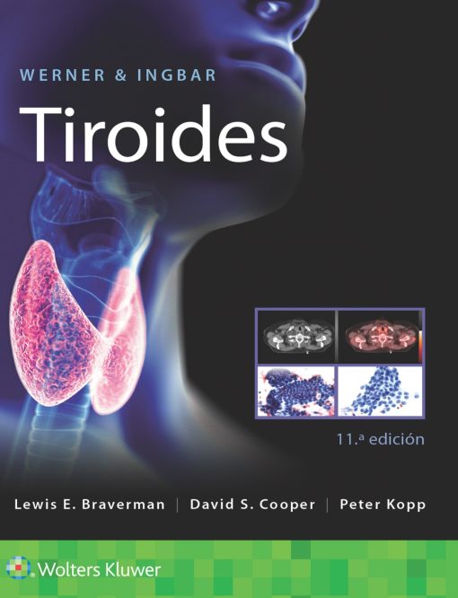 Werner & Ingbar. Tiroides, 11th edition (PDF)