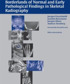 Koehler/Zimmer’s Borderlands of Normal and Early Pathological Findings in Skeletal Radiography, 5th edition (PDF)