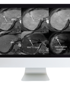 Liver, Pancreatic, and Biliary Tumors: Practical Tips to Improve Your Clinical Practice (Course)