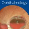 Ophthalmology PDF