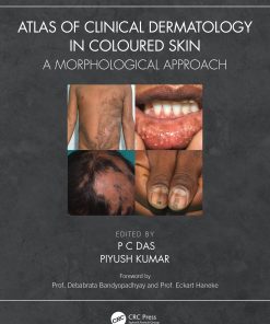 Atlas of Clinical Dermatology in Coloured Skin (EPUB)