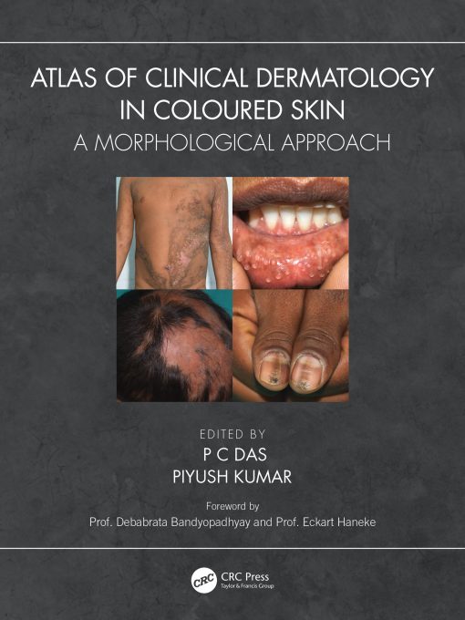 Atlas of Clinical Dermatology in Coloured Skin (EPUB)