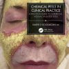 Chemical Peels in Clinical Practice (PDF)