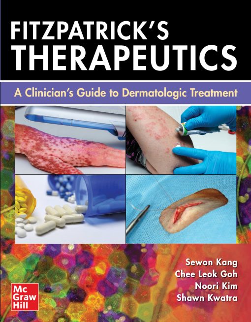 Fitzpatrick’s Therapeutics: A Clinician’s Guide to Dermatologic Treatment (PDF)