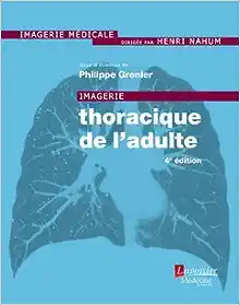 Imagerie Thoracique De L’adulte (French Edition), 4th edition (PDF)