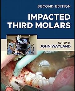 Impacted Third Molars, 2nd Edition (PDF)