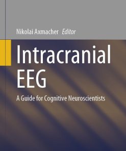 Intracranial EEG: A Guide for Cognitive Neuroscientists (PDF)