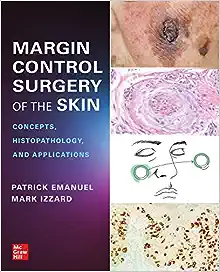 Margin Control Surgery of the Skin: Concepts, Histopathology, and Applications (EPUB)