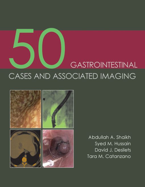 50 Gastrointestinal Cases and Associated Imaging (EPUB)