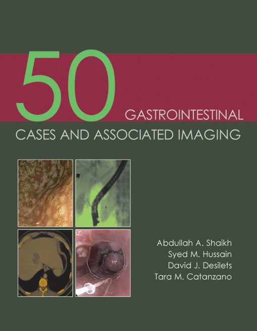 50 Gastrointestinal Cases and Associated Imaging (PDF)