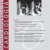 Revista Española de Cardiología (English Edition): Volume 73 (Issue 1 to Issue 12) 2020 PDF