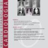 Revista Española de Cardiología (English Edition): Volume 73 (Issue 1 to Issue 12) 2020 PDF