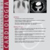 Revista Española de Cardiología (English Edition): Volume 75 (Issue 1 to Issue 12) 2022 PDF