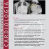 Revista Española de Cardiología (English Edition): Volume 76 (Issue 1 to Issue 12) 2023 PDF