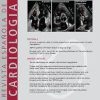 Revista Española de Cardiología (English Edition): Volume 76 (Issue 1 to Issue 12) 2023 PDF