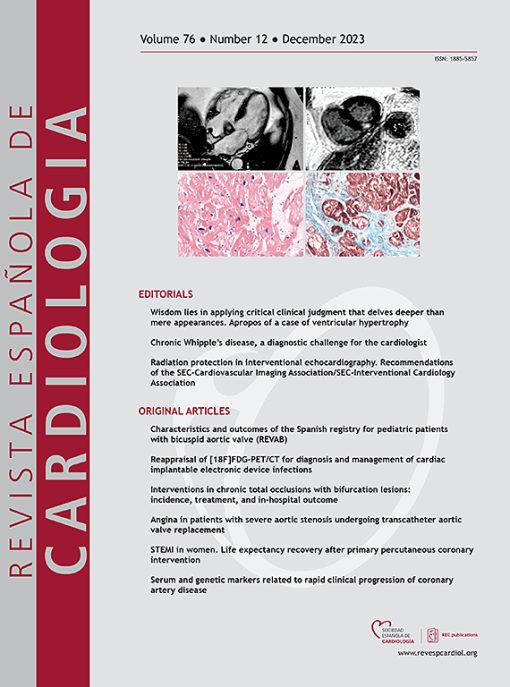 Revista Española de Cardiología (English Edition): Volume 76 (Issue 1 to Issue 12) 2023 PDF