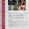 Revista Española de Cardiología (English Edition): Volume 76 (Issue 1 to Issue 12) 2023 PDF