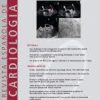 Revista Española de Cardiología (English Edition): Volume 76 (Issue 1 to Issue 12) 2023 PDF