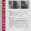 Revista Española de Cardiología (English Edition): Volume 76 (Issue 1 to Issue 12) 2023 PDF