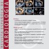 Revista Española de Cardiología (English Edition): Volume 76 (Issue 1 to Issue 12) 2023 PDF