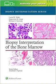 Biopsy Interpretation of the Bone Marrow (Biopsy Interpretation Series) (ePub Book)