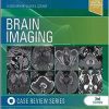 Brain Imaging: Case Review Series, 3rd edition (EPUB)