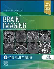 Brain Imaging: Case Review Series, 3rd edition (EPUB)