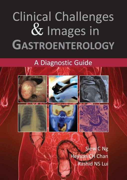 Clinical Challenges & Images in Gastroenterology (EPUB)