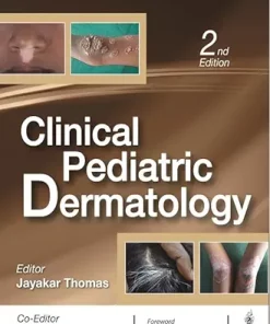 Clinical Pediatric Dermatology, 2nd Edition