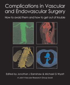 Complications in Vascular and Endovascular Surgery: How to avoid them and how to get out of trouble (EPUB Book)