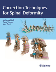 Correction Techniques for Spinal Deformity (PDF)