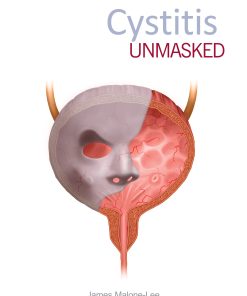 Cystitis unmasked (EPUB)