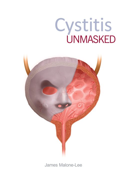 Cystitis unmasked (EPUB)