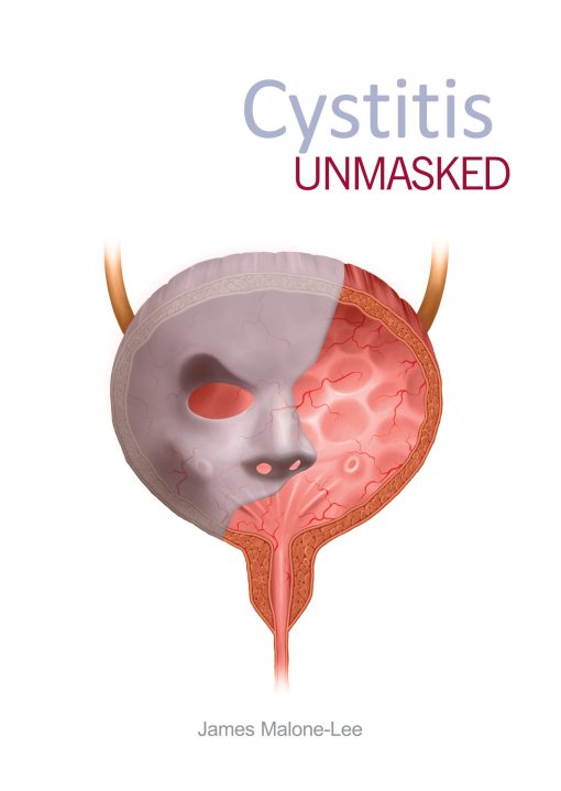 Cystitis unmasked (PDF)