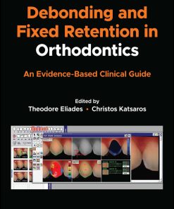 Debonding and Fixed Retention in Orthodontics (ePub Book)